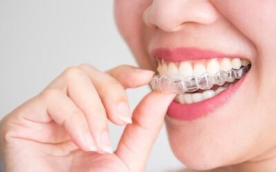 Invisalign en Quintana, Ventas y Ciudad Lineal