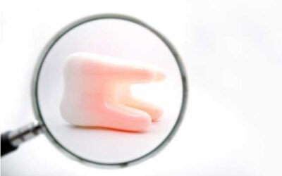 Infección de las muelas del juicio