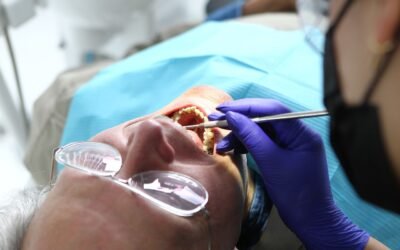 ¿Qué es una corona provisional sobre implantes?