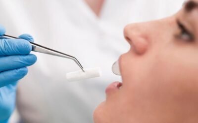 Injerto de encía ¿Qué es? Proceso, recuperación, consejos