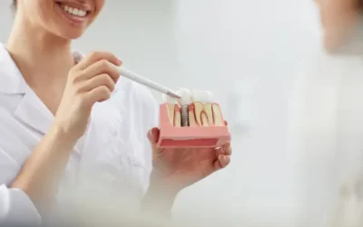 Tiempo entre extracción e implante dental: qué conviene esperar